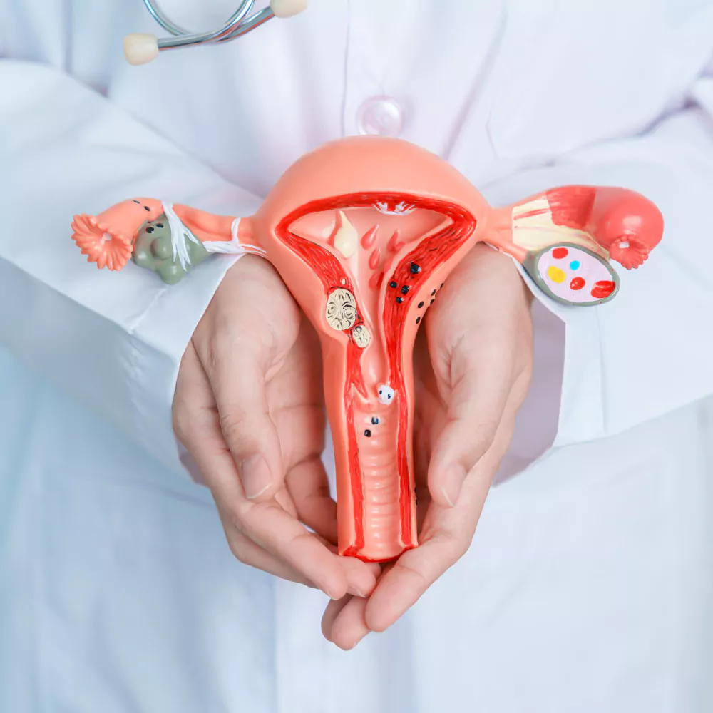 PCOS & PCOD Management
